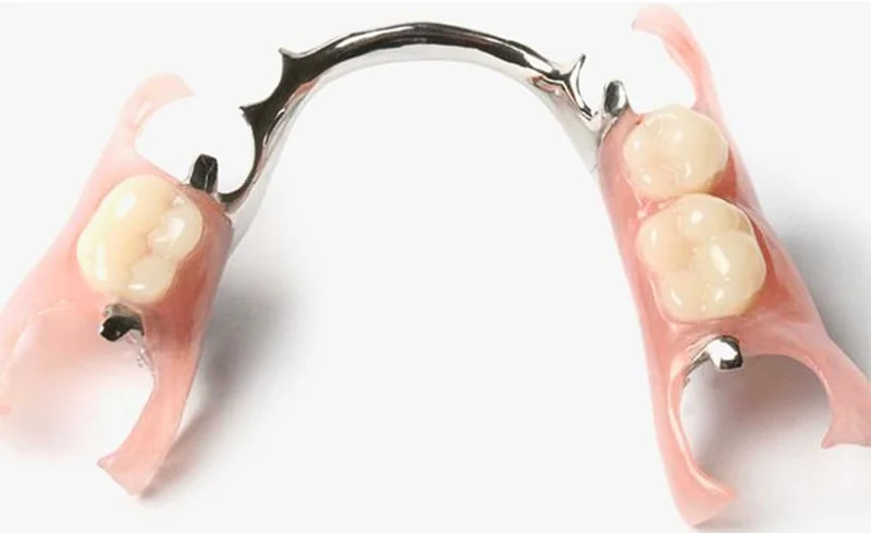 Gigi Palsu Frame (Kerangka Logam)