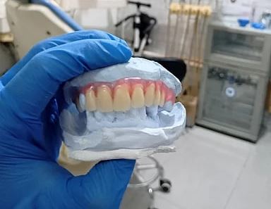 Kualitas gigi palsu yang nyaman dan tahan digunakan